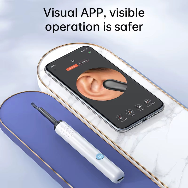 ClearView WiFi Ear Camera – HD Visual Ear Cleaner with LED Lights & Mini Earpick
